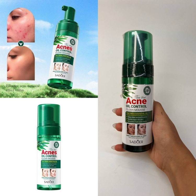 موس شستشوی صورت سادور • وزن : 150g • حاوی عصاره درخت چای و موادگیاهی • ضدالتهاب و التیام بخش پوست صورت • خشک کننده جوش و آکنه های پوست • کنترل چربی بیش از حد پوست صورت • بهبود و ترمیم جای جوش و آکنه صورت • ترمیم کننده بافت آسیب دیده پوست • تغذیه رسانی به سلولهای پوست • پاک کننده عمیق منافذ پوست • رفع کامل جوش و آکنه پوست