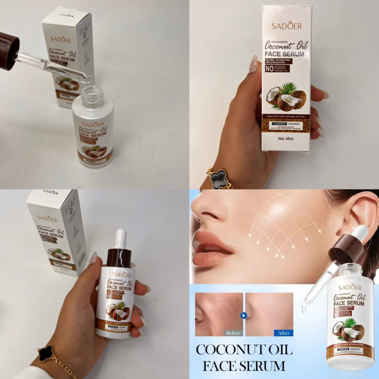 سرم صورت روغن نارگیل • حجم : 40mL • مرطوب کردن و ترمیم پوست خشک و حساس • کاهش التهابها و عفونتهای پوستی • درمان آکنه، جوش، خارش و التهابات پوستی • مقابله با آسیبهای ناشی از رادیکالهای آزاد و عوامل پیری پوست، حفظ جوانی و تاخیر در پیری پوست • با رایحه خوش نارگیل • تسکیندهنده و آرامش بخش •( انقضا :2028/10/01 )